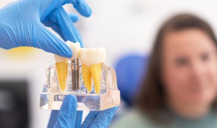 Implant model showing tooth integration