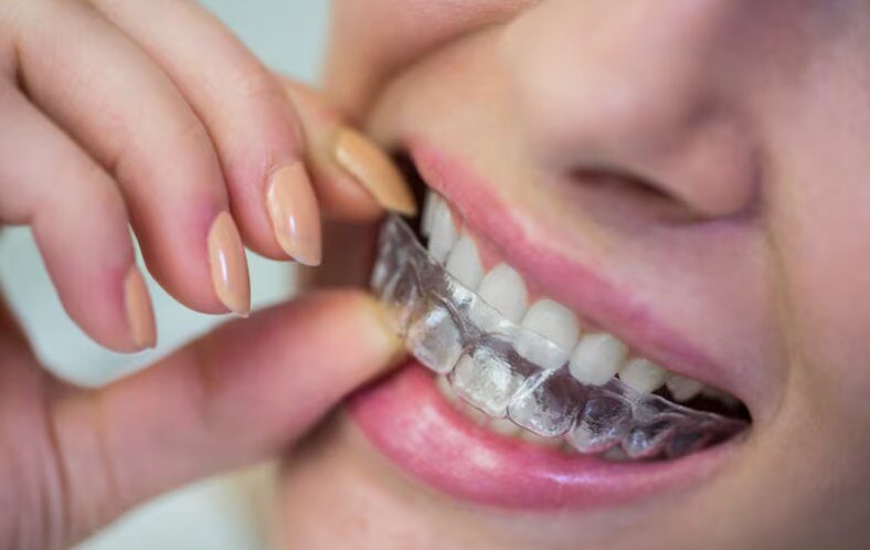 Patient smiling with clear aligner